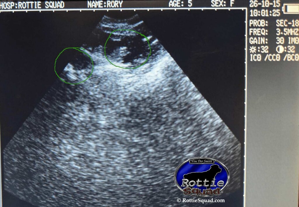 Ultrasound 31 days 2